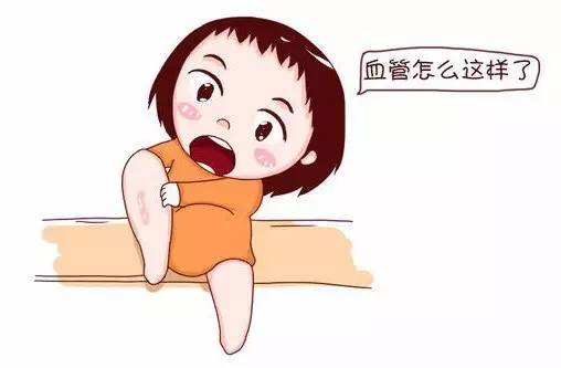 哈尔滨哪个医院看静脉血栓技术好