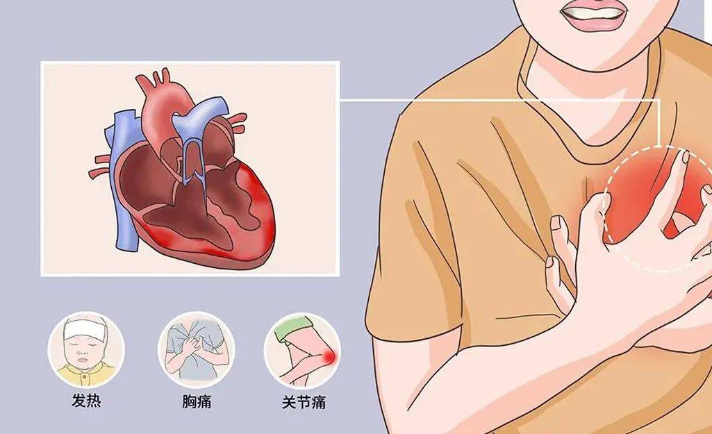 前胸后背疼是什么原因导致的哈尔滨治心脏病医院哪家好
