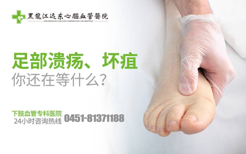 腿血栓是什么症状?哈尔滨那家医院治疗小腿动脉血栓好