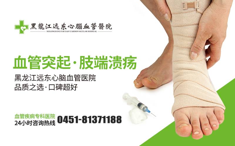 治糖尿病足有什么好办法?哈尔滨治静脉曲张哪个医院好