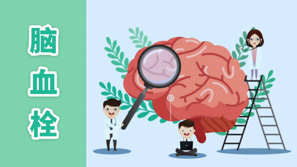 怎样治疗脑血栓?切勿无视哈尔滨脑血管医院哪家好