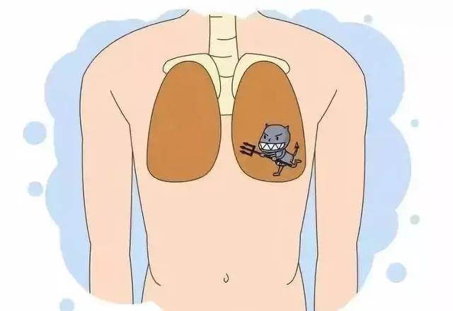 肺上有结节怎么办？哈尔滨肺结节,肺结节
