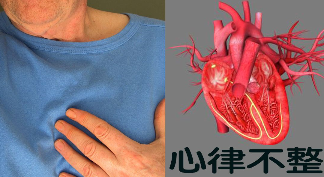 【精选】窦性心律什么意思？哈尔滨心脏病检查,哈尔滨先天性心脏病
