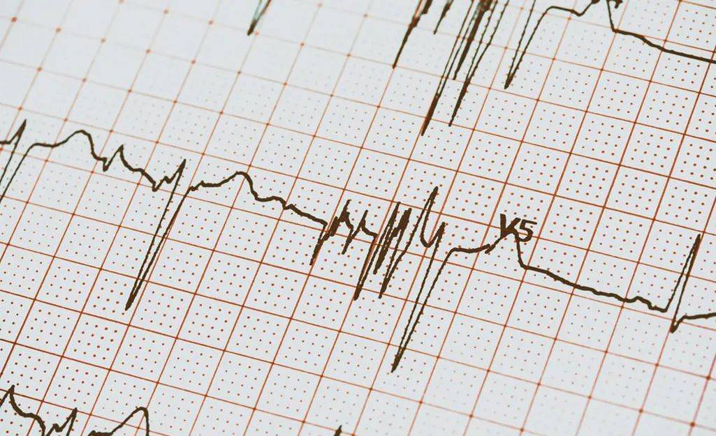 心率不齐的表现是什么症状？一文讲清楚哈尔滨心脏病专家
